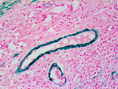 IHC of Myosin Smooth Muscle Heavy Chain on an FFPE Appendix Tissue